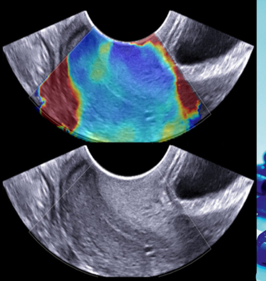 Open registrations for the PASREL-Imagerie scientific day – February 9, 2024