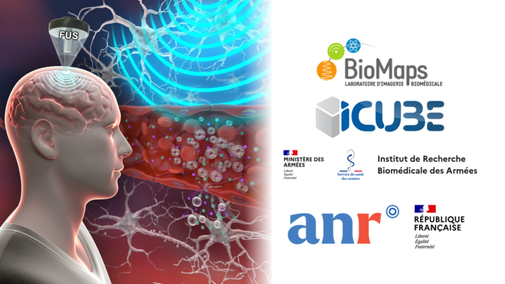 Projet OPUS retenu par l’ANR – BioMaps, IRBA, ICube
