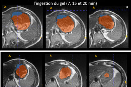 L’expertise IRM de BioMaps pour caractériser la solution innovante de Jellynov