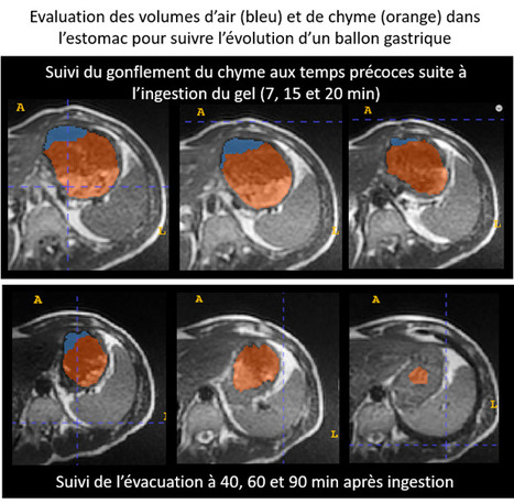 L’expertise IRM de BioMaps pour caractériser la solution innovante de Jellynov